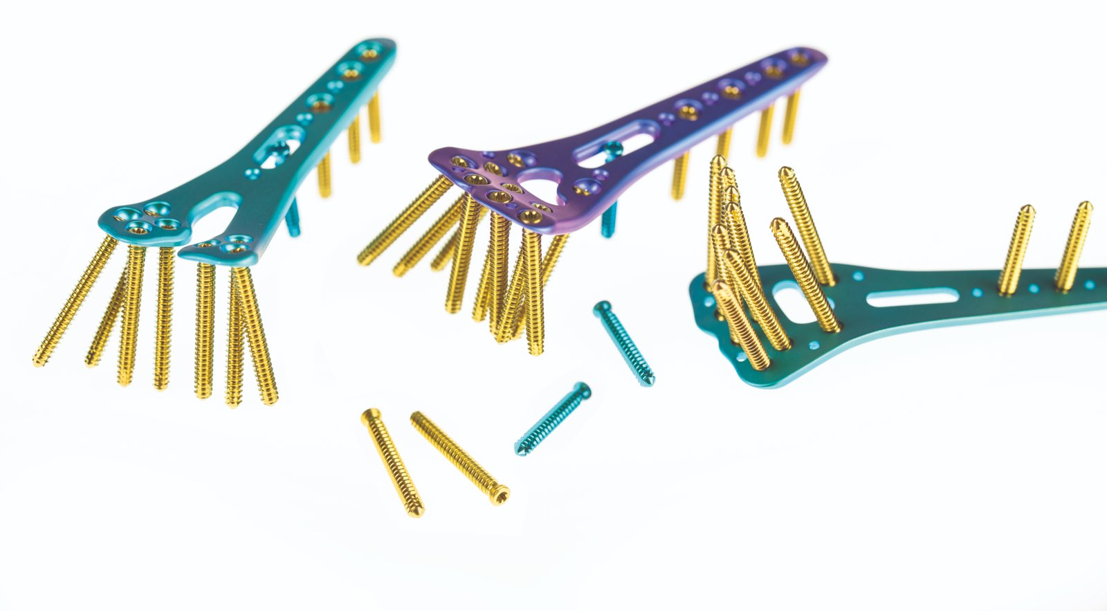 Hofer titanium locking plate system for fracture fixation